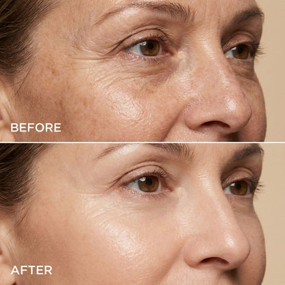 MERCILEN - MIRADA RADIANTE