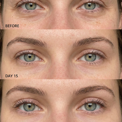 MERCILEN - MIRADA RADIANTE